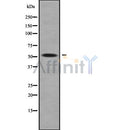 Western blot analysis of PIGA using COLO205 whole cell lysates