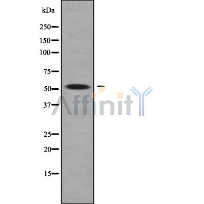 Western blot analysis of PIGA using COLO205 whole cell lysates