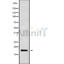 Western blot analysis of extracts from Cos-7, using PIGP Antibody. Lane 1 was treated with the blocking peptide.