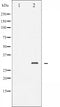 AF3140 staining MCF7 by IF/ICC. The sample were fixed with PFA and permeabilized in 0.1% Triton X-100,then blocked in 10% serum for 45 minutes at 25¡ãC. The primary antibody was diluted at 1/200 and incubated with the sample for 1 hour at 37¡ãC. An  Alexa Fluor 594 conjugated goat anti-rabbit IgG (H+L) Ab, diluted at 1/600, was used as the secondary antibod