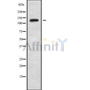 Western blot analysis INPPL1 using Jurkat whole cell lysates
