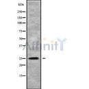 Western blot analysis of extracts from Hela, using PIGF Antibody. Lane 1 was treated with the blocking peptide.