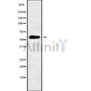Western blot analysis of PIGW using MCF7 whole cell lysates