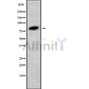 Western blot analysis of PIK3R6 using HuvEc whole cell lysates
