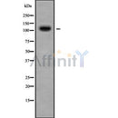 DF9752 staining  Hela cells by IF/ICC. The sample were fixed with PFA and permeabilized in 0.1% Triton X-100,then blocked in 10% serum for 45 minutes at 25¡ãC. The primary antibody was diluted at 1/200 and incubated with the sample for 1 hour at 37¡ãC. An  Alexa Fluor 594 conjugated goat anti-rabbit IgG (H+L) antibody(Cat.