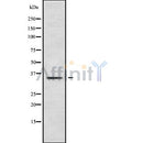 Western blot analysis of extracts from mouse brain, using PLSCR2 Antibody. Lane 1 was treated with the blocking peptide.