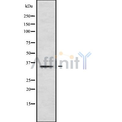 Western blot analysis of extracts from mouse brain, using PLSCR2 Antibody. Lane 1 was treated with the blocking peptide.