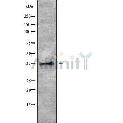 Western blot analysis of PLSCR4 using MCF7 whole cell lysates