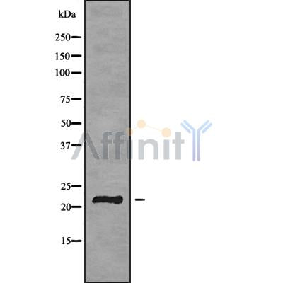 Western blot analysis of extracts from VERO, using GP1BB Antibody. The lane on the left was treated with blocking peptide.
