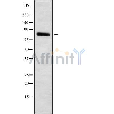 Western blot analysis of extracts from Rat  brain, using HCN3 Antibody. The lane on the left was treated with blocking peptide.