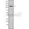 DF9772 at 1/100 staining Rat brain tissue by IHC-P. The sample was formaldehyde fixed and a heat mediated antigen retrieval step in citrate buffer was performed. The sample was then blocked and incubated with the antibody for 1.5 hours at 22¡ãC. An HRP conjugated goat anti-rabbit antibody was used as the secondary