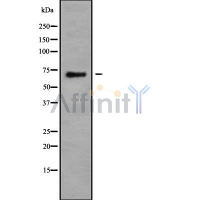 Western blot analysis of extracts from Mouse muscle, using PRPF38B Antibody. The lane on the left was treated with blocking peptide.