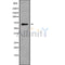 Western blot analysis of extracts from Mouse muscle, using PRPF38B Antibody. The lane on the left was treated with blocking peptide.