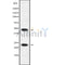 Western blot analysis of APOBEC3A/B using HuvEc whole cell lysates