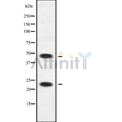 Western blot analysis of APOBEC3A/B using HuvEc whole cell lysates