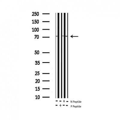 AF3143 staining HepG2 by IF/ICC. The sample were fixed with PFA and permeabilized in 0.1% Triton X-100,then blocked in 10% serum for 45 minutes at 25¡ãC. The primary antibody was diluted at 1/200 and incubated with the sample for 1 hour at 37¡ãC. An  Alexa Fluor 594 conjugated goat anti-rabbit IgG (H+L) Ab, diluted at 1/600, was used as the secondary antibod