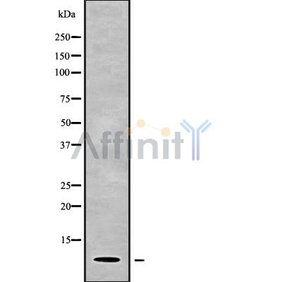 Western blot analysis of PART1 using HuvEc whole cell lysates