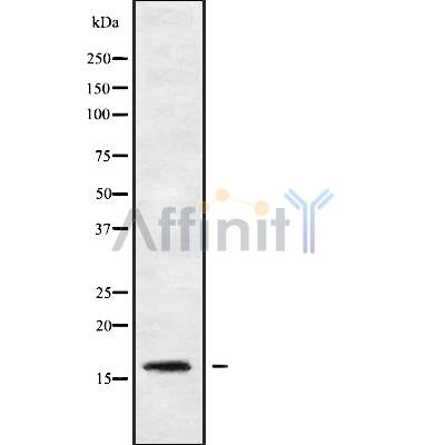 Western blot analysis of extracts from 293, using PPP1R14B Antibody. Lane 1 was treated with the blocking peptide.
