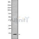 Western blot analysis of extracts from Hela, using PPP1R1C Antibody. The lane on the left was treated with blocking peptide.