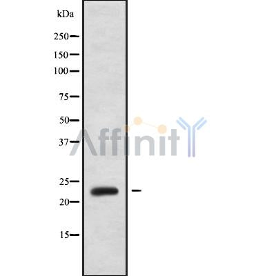 Western blot analysis of extracts from mouse lung, using PPP1R2P3 Antibody. Lane 1 was treated with the blocking peptide.