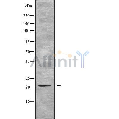 DF9789 at 1/100 staining Human lymph node tissue by IHC-P. The sample was formaldehyde fixed and a heat mediated antigen retrieval step in citrate buffer was performed. The sample was then blocked and incubated with the antibody for 1.5 hours at 22¡ãC. An HRP conjugated goat anti-rabbit antibody was used as the secondary
