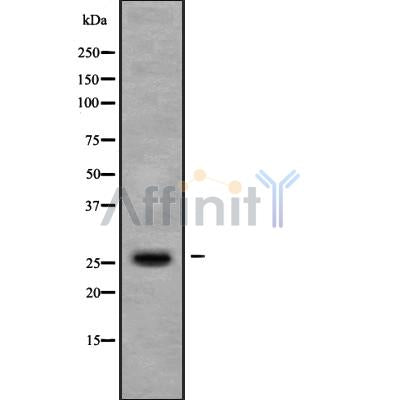 Western blot analysis of TIGA1 using COLO205 whole cell lysates