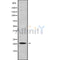 DF9798 at 1/100 staining Human prostate tissue by IHC-P. The sample was formaldehyde fixed and a heat mediated antigen retrieval step in citrate buffer was performed. The sample was then blocked and incubated with the antibody for 1.5 hours at 22¡ãC. An HRP conjugated goat anti-rabbit antibody was used as the secondary