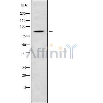 DF9800 at 1/100 staining Human brain cancer tissue by IHC-P. The sample was formaldehyde fixed and a heat mediated antigen retrieval step in citrate buffer was performed. The sample was then blocked and incubated with the antibody for 1.5 hours at 22¡ãC. An HRP conjugated goat anti-rabbit antibody was used as the secondary