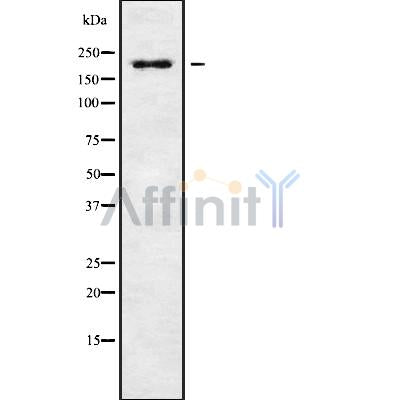 Western blot analysis of RGPD5 using A549 whole cell lysates