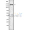 Western blot analysis of RGPD5 using A549 whole cell lysates