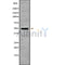 DF9804 at 1/100 staining Rat brain tissue by IHC-P. The sample was formaldehyde fixed and a heat mediated antigen retrieval step in citrate buffer was performed. The sample was then blocked and incubated with the antibody for 1.5 hours at 22¡ãC. An HRP conjugated goat anti-rabbit antibody was used as the secondary