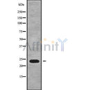 Western blot analysis of extracts from mouse brain,mouse liver,rat brain, using RAB15 Antibody.