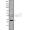 Western blot analysis of extracts from mouse brain,mouse liver,rat brain, using RAB15 Antibody.