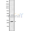 Western blot analysis of RAB17 using HuvEc whole cell lysates