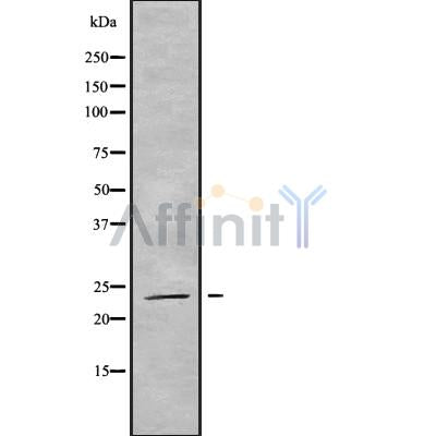 Western blot analysis of RAB19 using HT29 whole cell lysates