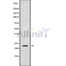 Western blot analysis of RAB1A using HT29 whole cell lysates