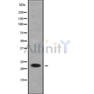 Western blot analysis of extracts from Hela, using RAB1B Antibody. Lane 1 was treated with the blocking peptide.