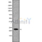 Western blot analysis of extracts from Hela, using RAB1B Antibody. Lane 1 was treated with the blocking peptide.