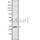 Western blot analysis of RAB21 using LOVO whole cell lysates