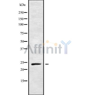 Western blot analysis of RAB21 using LOVO whole cell lysates