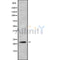 DF9820 at 1/100 staining Mouse kidney tissue by IHC-P. The sample was formaldehyde fixed and a heat mediated antigen retrieval step in citrate buffer was performed. The sample was then blocked and incubated with the antibody for 1.5 hours at 22¡ãC. An HRP conjugated goat anti-rabbit antibody was used as the secondary