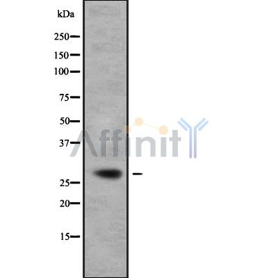 DF9821 at 1/100 staining Mouse kidney tissue by IHC-P. The sample was formaldehyde fixed and a heat mediated antigen retrieval step in citrate buffer was performed. The sample was then blocked and incubated with the antibody for 1.5 hours at 22¡ãC. An HRP conjugated goat anti-rabbit antibody was used as the secondary
