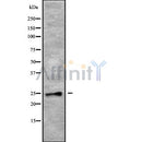 Western blot analysis of extracts from mouse heart and rat spleen, using RAB28 Antibody.