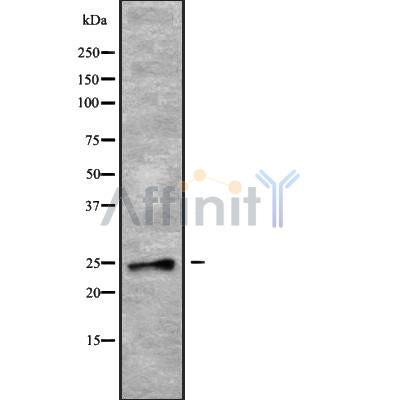 Western blot analysis of extracts from mouse heart and rat spleen, using RAB28 Antibody.