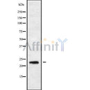 Western blot analysis of RAB30 using K562 whole cell lysates