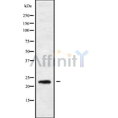 Western blot analysis of RAB30 using K562 whole cell lysates