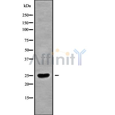 DF9825 at 1/100 staining Mouse colon tissue by IHC-P. The sample was formaldehyde fixed and a heat mediated antigen retrieval step in citrate buffer was performed. The sample was then blocked and incubated with the antibody for 1.5 hours at 22¡ãC. An HRP conjugated goat anti-rabbit antibody was used as the secondary