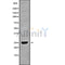 DF9825 at 1/100 staining Mouse colon tissue by IHC-P. The sample was formaldehyde fixed and a heat mediated antigen retrieval step in citrate buffer was performed. The sample was then blocked and incubated with the antibody for 1.5 hours at 22¡ãC. An HRP conjugated goat anti-rabbit antibody was used as the secondary