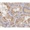 AF0199 at 1/200 staining human kidney tissue sections by IHC-P. The tissue was formaldehyde fixed and a heat mediated antigen retrieval step in citrate buffer was performed. The tissue was then blocked and incubated with the antibody for 1.5 hours at 22¡ãC. An HRP conjugated goat anti-rabbit antibody was used as the secondary