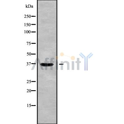 Western blot analysis of RAB36 using Jurkat whole cell lysates